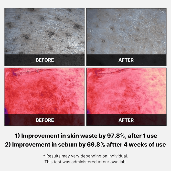 Medicube Red Succinic Peeling Pad 155g - Beauty Tribe